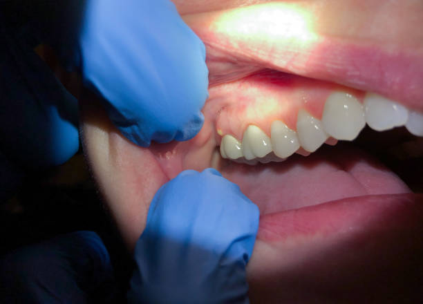 Best Emergency Treatment for Jaw Pain or Injury in Valley Center, KS